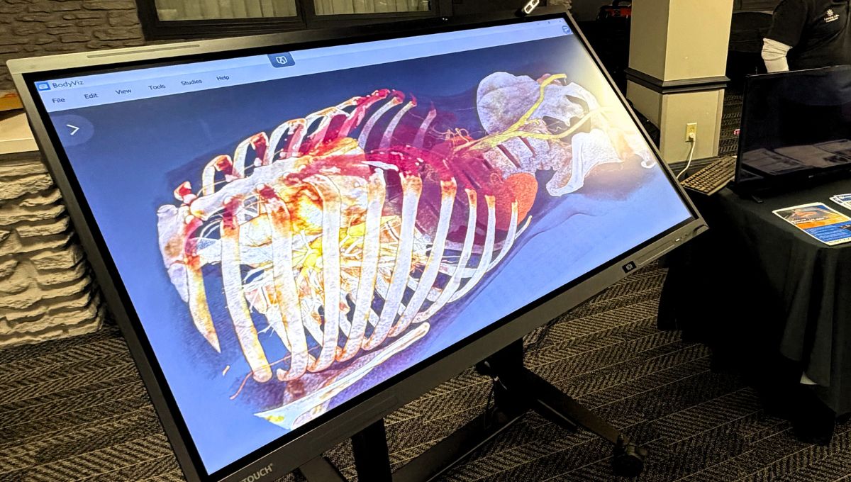 BodyViz Anatomy Table in Preop Teaching