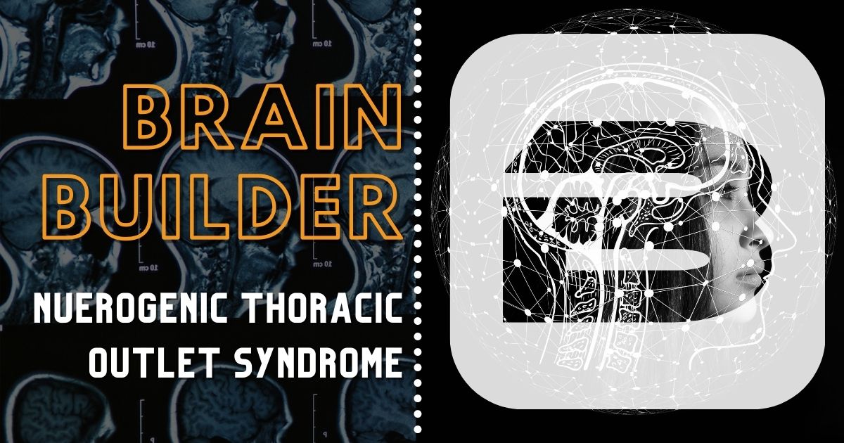 Thoracic Outlet Syndrome visualized with 3D Anatomy