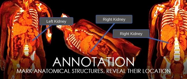 Annotation - Mark anatomical structures, reveal their location