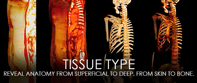 Tissue Type - Reveal anatomy from superficial to deep, from kin to bone.