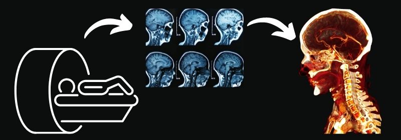 Converting and MRI CT Scan with BodyViz