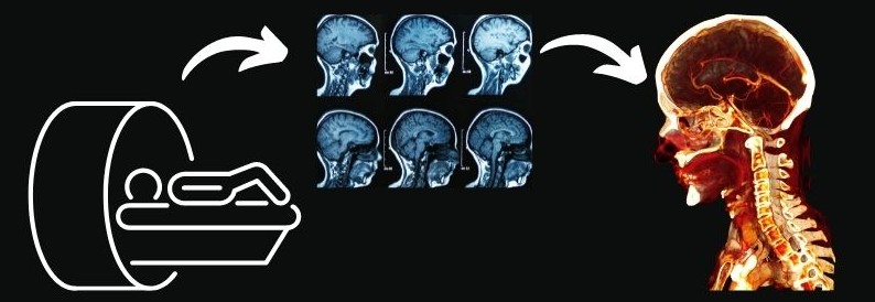 Converting and MRI CT Scan with BodyViz