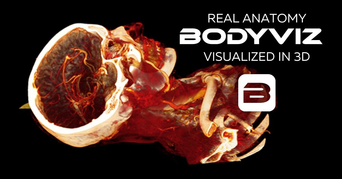 Cerebral Vessels of the skull with BodyViz Anatomy