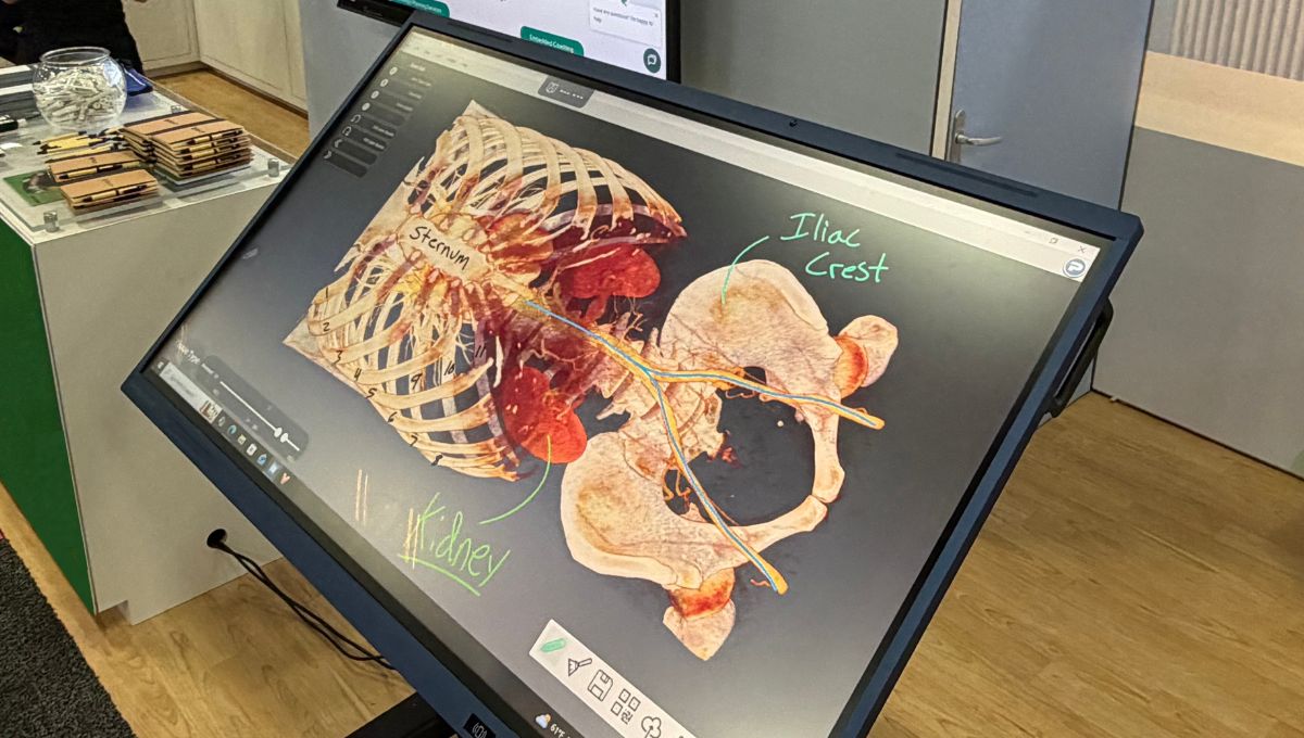 BodyViz Anatomy Table vs. Anatomage Table