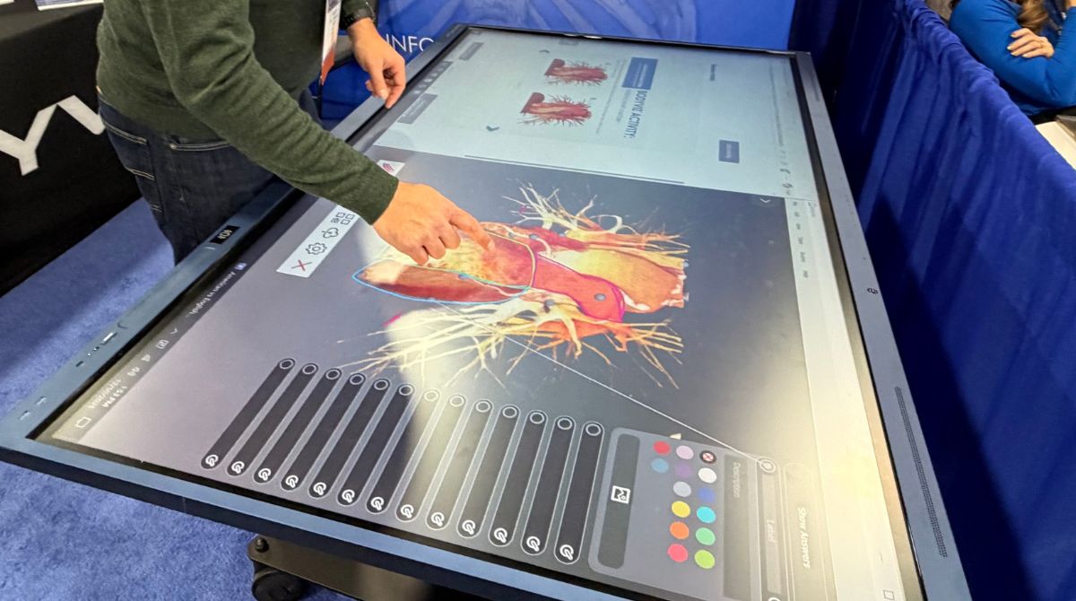 BodyViz Virtual Dissection Table
