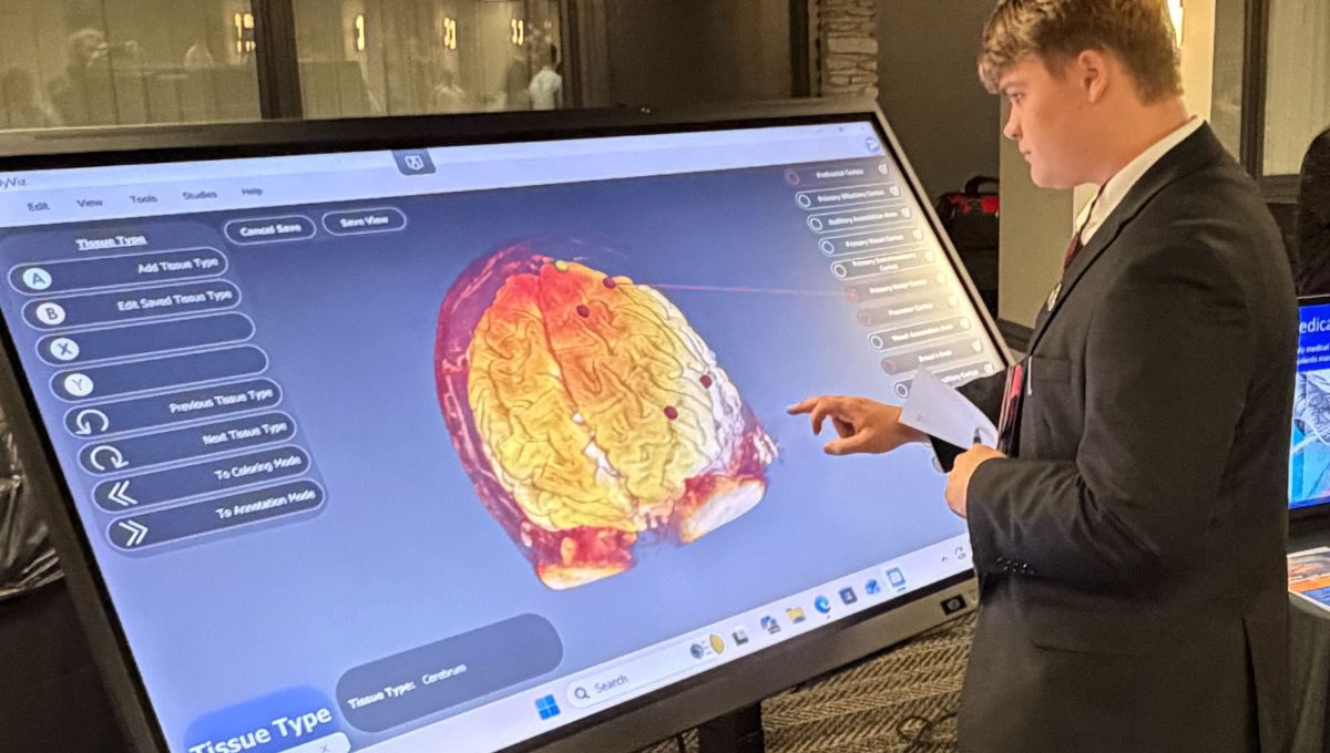 Virtual Dissection Tables Support Anatomy Retention